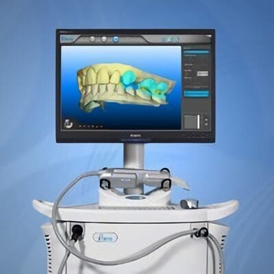 iTero Digital Scanner